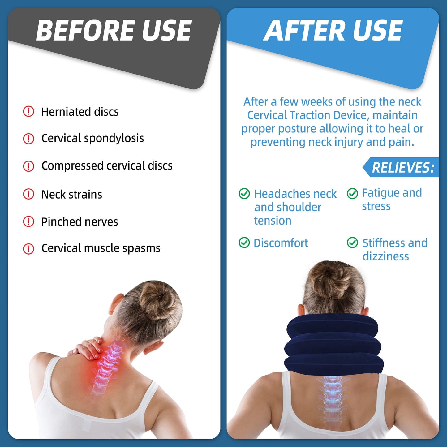 Sentryse Neck Stretcher for Pain Relief, Cervical Neck Traction Device, Adjustable Inflatable Neck Brace, Neck Traction Pillow for Home Use Neck Decompression, Blue